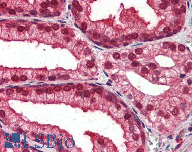 Anti-NOTCH4 antibody IHC of human prostate. Immunohistochemistry of formalin-fixed, paraffin-embedded tissue after heat-induced antigen retrieval. Antibody LS-B3498 concentration 5 ug/ml.
