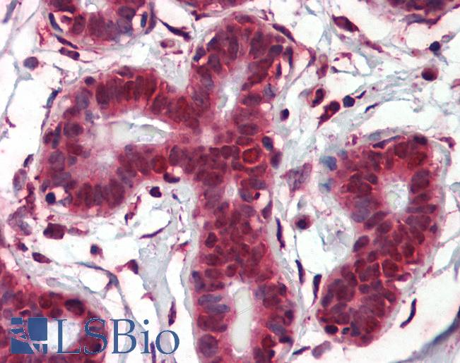 Anti-NOTCH4 antibody IHC of human breast. Immunohistochemistry of formalin-fixed, paraffin-embedded tissue after heat-induced antigen retrieval. Antibody LS-B3498 concentration 5 ug/ml.