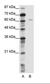 A: Marker, B: Jurkat Cell Lysate.