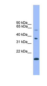 NOTCH4 antibody LS-C116886 Western blot of Jurkat lysate.