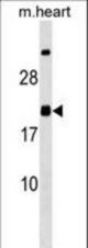 MED9 Antibody western blot of mouse heart tissue lysates (35 ug/lane). The MED9 Antibody detected the MED9 protein (arrow).