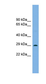 NOTO antibody LS-C115986 Western blot of Mouse Brain lysate.
