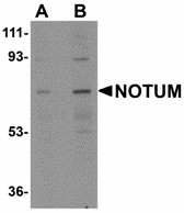 Western blot of NOTUM in human kidney tissue lysate with NOTUM antibody at (A) 0.5 and (B) 1 ug/ml. Below: Immunohistochemistry of NOTUM in human brain tissue with NOTUM antibody at 2.5 ug/ml.