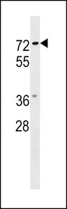 NOTUM Antibody western blot of MCF-7 cell line lysates (35 ug/lane). The NOTUM antibody detected the NOTUM protein (arrow).