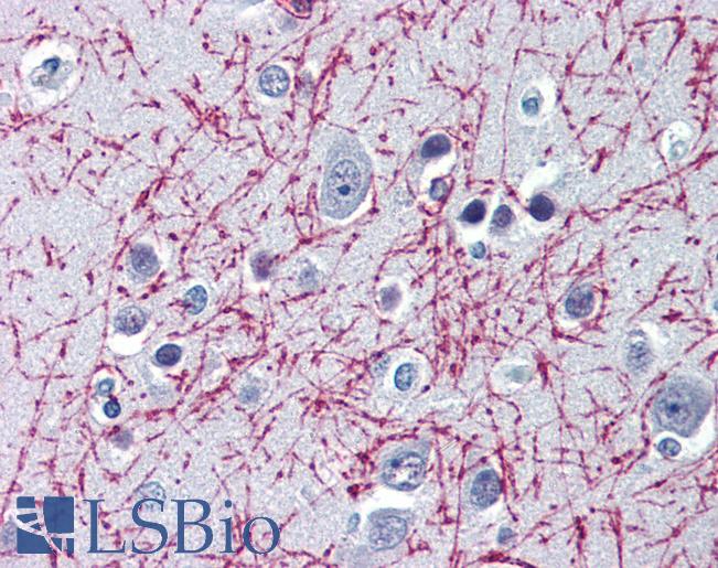 Anti-NOVA1 antibody IHC of human brain, cortex. Immunohistochemistry of formalin-fixed, paraffin-embedded tissue after heat-induced antigen retrieval. Antibody LS-B3085 concentration 5 ug/ml.