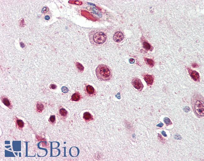 Anti-NOVA1 antibody IHC of human brain, cortex. Immunohistochemistry of formalin-fixed, paraffin-embedded tissue after heat-induced antigen retrieval. Antibody LS-B3259 concentration 5 ug/ml.