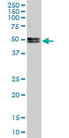 NOVA1 monoclonal antibody (M10), clone 5D9. Western blot of NOVA1 expression in PC-12.