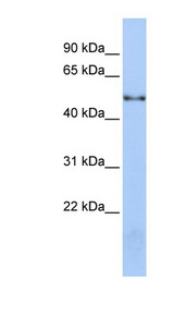 NOVA1 antibody LS-C101838 Western blot of Jurkat lysate.