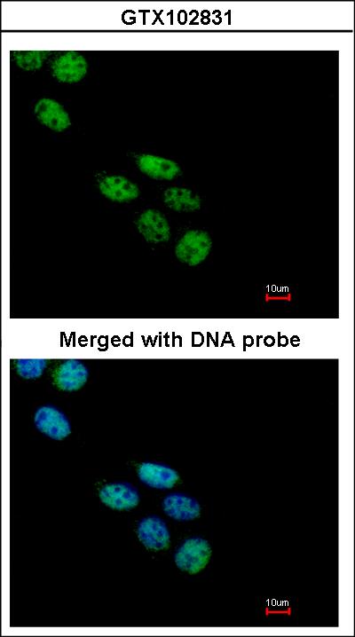 Immunofluorescence of paraformaldehyde-fixed A431 using NOVA1 antibody at 1:200 dilution.