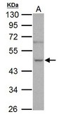 Sample (30 ug of whole cell lysate). A: PC-3. 10% SDS PAGE. NOVA1 antibody diluted at 1:1000.