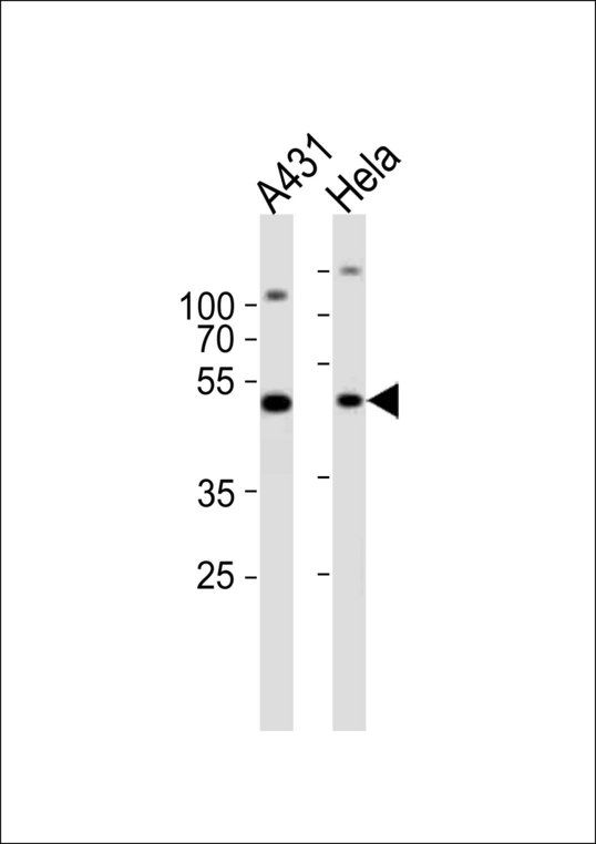 Western blot of lysates from A431, HeLa cell line (from left to right) with NOVA1 Antibody. Antibody was diluted at 1:1000 at each lane. A goat anti-rabbit IgG H&L (HRP) at 1:10000 dilution was used as the secondary antibody. Lysates at 20 ug per lane.