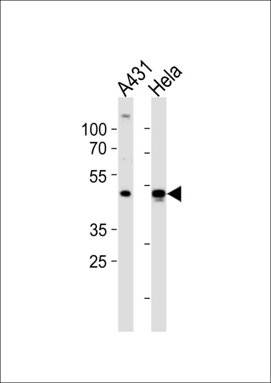 Western blot of lysates from A431, HeLa cell line (from left to right) with NOVA1 Antibody. Antibody was diluted at 1:1000 at each lane. A goat anti-rabbit IgG H&L (HRP) at 1:10000 dilution was used as the secondary antibody. Lysates at 20 ug per lane.