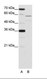 A: Marker, B: HepG2 Cell Lysate