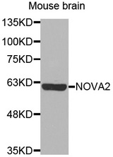Western blot analysis of extracts of Mouse brain cell line, using NOVA2 antibody.