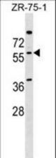 NOVA2 Antibody western blot of ZR-75-1 cell line lysates (35 ug/lane). The NOVA2 antibody detected the NOVA2 protein (arrow).