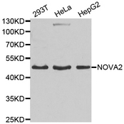 Western blot analysis of extracts of various cell lines, using NOVA2 antibody.