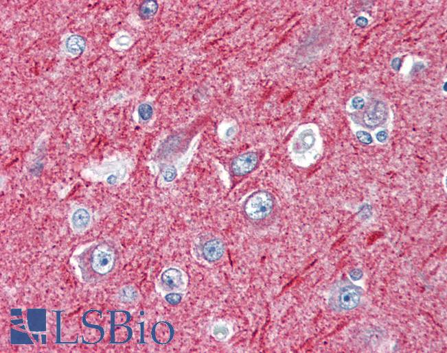 Anti-NOVA2 antibody IHC of human brain, cortex. Immunohistochemistry of formalin-fixed, paraffin-embedded tissue after heat-induced antigen retrieval. Antibody LS-B3084 concentration 5 ug/ml.