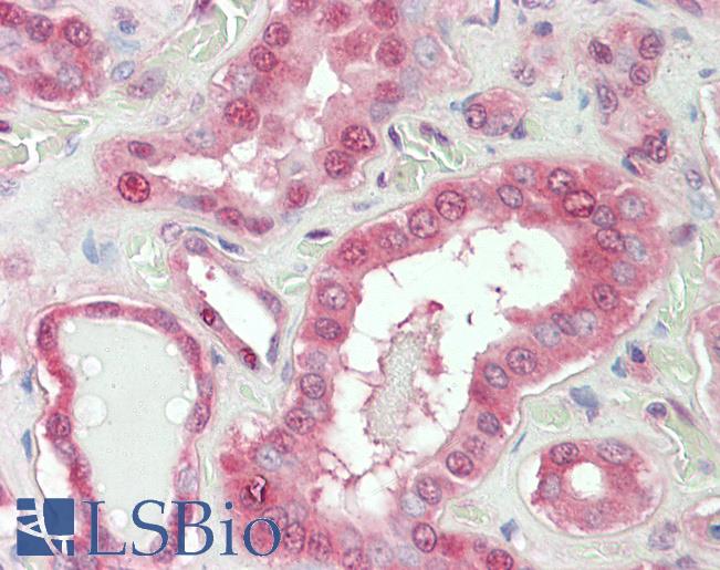 Anti-NOX1 antibody IHC staining of human kidney. Immunohistochemistry of formalin-fixed, paraffin-embedded tissue after heat-induced antigen retrieval. Antibody LS-B11179 concentration 5 ug/ml.