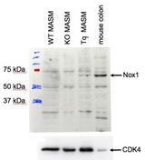 NOX1 antibody (1 ug/ml) staining of MASM lysate (35 ug protein in RIPA buffer). Primary incubation was 1 hour. Detected by chemiluminescence. CDK4 served as a loading control. Data provided by Everest Grant winner Dr. B. Lasseque, Emory University, Atlanta, USA