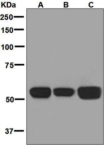 Western blot analysis on (A) MCF-7, (B) HepG2, and (C) Caco-2 cell lysates using anti-NOX2 antibody.