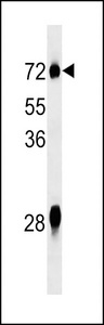 NOX3 Antibody western blot of mouse liver tissue lysates (35 ug/lane). The NOX3 Antibody detected the NOX3 protein (arrow).