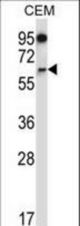 NOX4 Antibody western blot of CEM cell line lysates (35 ug/lane). The NOX4 antibody detected the NOX4 protein (arrow).
