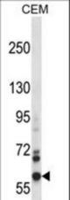 NOX5 Antibody western blot of CEM cell line lysates (35 ug/lane). The NOX5 antibody detected the NOX5 protein (arrow).
