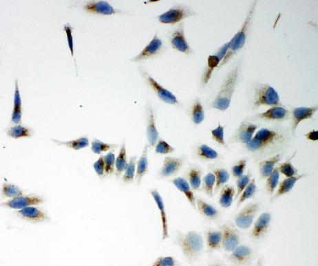 NOX5 antibody. ICC: HELA Cell.