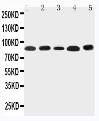 WB of NOX5 antibody. Lane 1: Rat Testis Tissue Lysate. Lane 2: Rat Spleen Tissue Lysate. Lane 3: Rat Ovary Tissue Lysate. Lane 4: HELA Cell Lysate. Lane 5: SKOV-3 Cell Lysate.