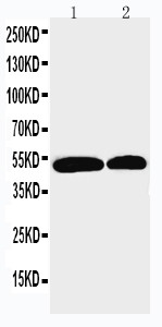 WB of NOXA1 antibody. Lane 1: U87 Cell Lysate. Lane 2: HELA Cell Lysate.