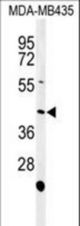 Western blot of NOXA1 Antibody in MDA-MB435 cell line lysates (35 ug/lane). NOXA1 (arrow) was detected using the purified antibody.