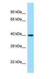 NOXO1 antibody Western Blot of Human Kidney.