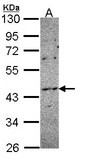 Sample (30 ug of whole cell lysate). A: HCT116 10% SDS PAGE. NOXO1 antibody diluted at 1:1000.