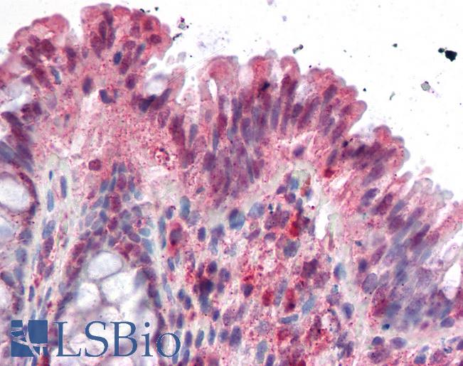 Anti-NOXO1 antibody IHC of human colon. Immunohistochemistry of formalin-fixed, paraffin-embedded tissue after heat-induced antigen retrieval. Antibody LS-B485 concentration 10 ug/ml.