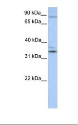 Fetal heart lysate. Antibody concentration: 1.0 ug/ml. Gel concentration: 12%.