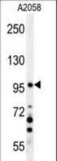 NPAS2 Antibody western blot of A2058 cell line lysates (35 ug/lane). The NPAS2 antibody detected the NPAS2 protein (arrow).
