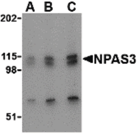 Western blot of NPAS3 in SK-N-SH cell lysate with NPAS3 antibody at (A) 0.5, (B) 1 and (C) 2 ug/ml.