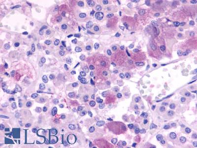Anti-NPBWR1 antibody LS-A172 IHC of human brain, pituitary. Immunohistochemistry of formalin-fixed, paraffin-embedded tissue after heat-induced antigen retrieval.