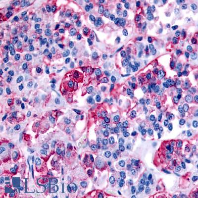 Anti-NPBWR1 antibody LS-A171 IHC of human brain, pituitary. Immunohistochemistry of formalin-fixed, paraffin-embedded tissue after heat-induced antigen retrieval.