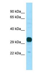 NPBWR1 / GPR7 antibody Western Blot of Fetal Brain.
