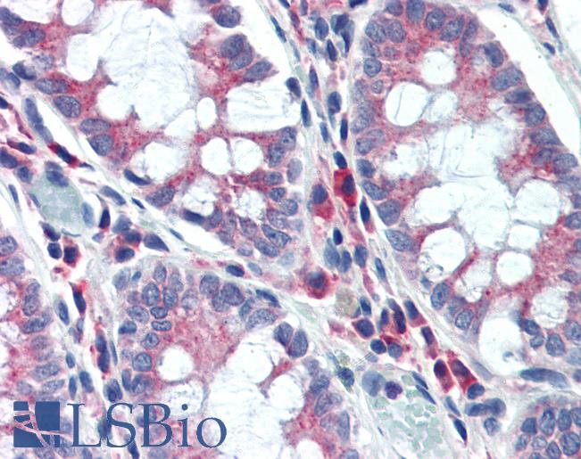 Anti-NPC1 antibody IHC of human colon. Immunohistochemistry of formalin-fixed, paraffin-embedded tissue after heat-induced antigen retrieval. Antibody LS-B3437 concentration 10 ug/ml.