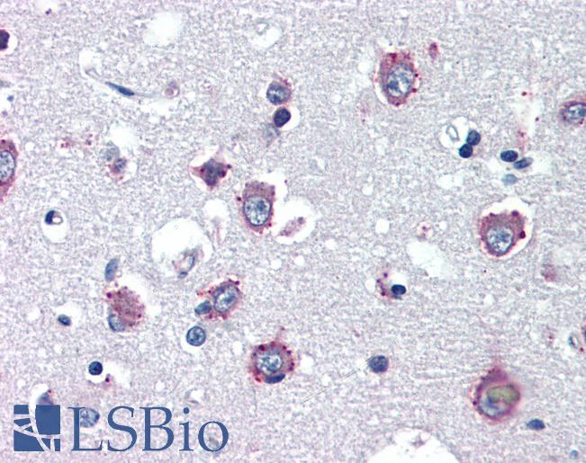 Anti-NPC1 antibody IHC of human brain, cortex. Immunohistochemistry of formalin-fixed, paraffin-embedded tissue after heat-induced antigen retrieval. Antibody LS-B3437 concentration 10 ug/ml.