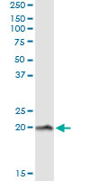 Immunoprecipitation of NPC2 transfected lysate using anti-NPC2 monoclonal antibody and Protein A Magnetic Bead.