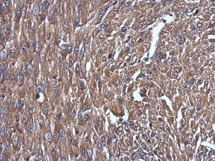 IHC of paraffin-embedded U87 xenograft, using NPC2 antibody at 1:500 dilution.