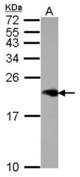 Sample (30 ug of whole cell lysate) A: HeLa 15% SDS PAGE NPC2 antibody diluted at 1:1000