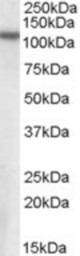 Antibody (0.3 ug/ml) staining of Human Brain (Cerebral Cortex) lysate (35 ug protein in RIPA buffer). Primary incubation was 1 hour. Detected by chemiluminescence.