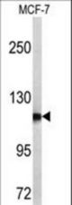 Western blot of PSA antibody in MCF-7 cell line lysates (35 ug/lane). PSA (arrow) was detected using the purified antibody.