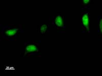 Immunostaining analysis in HeLa cells. HeLa cells were fixed with 4% paraformaldehyde and permeabilized with 0.1% Triton X-100 in PBS. The cells were immunostained with anti-NPEPPS mAb.