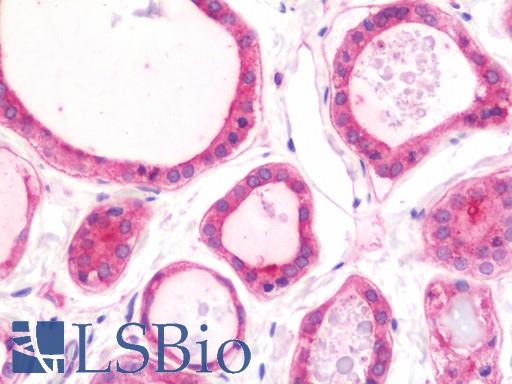 Anti-NPEPPS antibody IHC staining of human thyroid. Immunohistochemistry of formalin-fixed, paraffin-embedded tissue after heat-induced antigen retrieval. Antibody LS-B10860 concentration 7.5 ug/ml.
