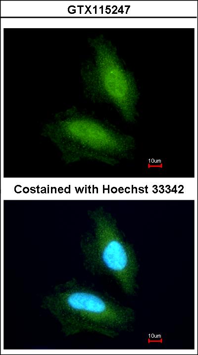 Immunofluorescence of paraformaldehyde-fixed HeLa using NPEPPS antibody at 1:200 dilution.